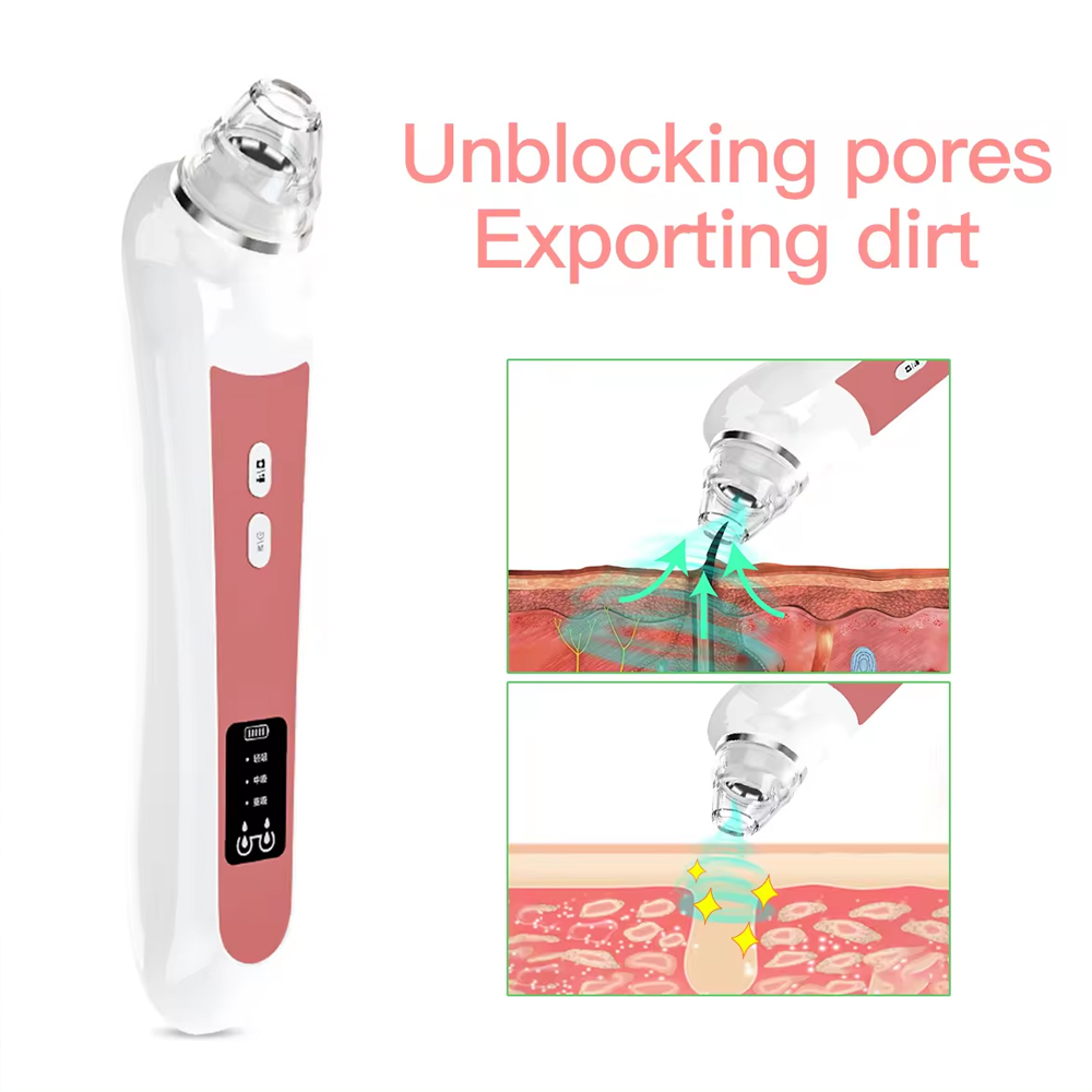 Aspirador cravo com câmera, Ex - Pore Vacuum avaliação e preço