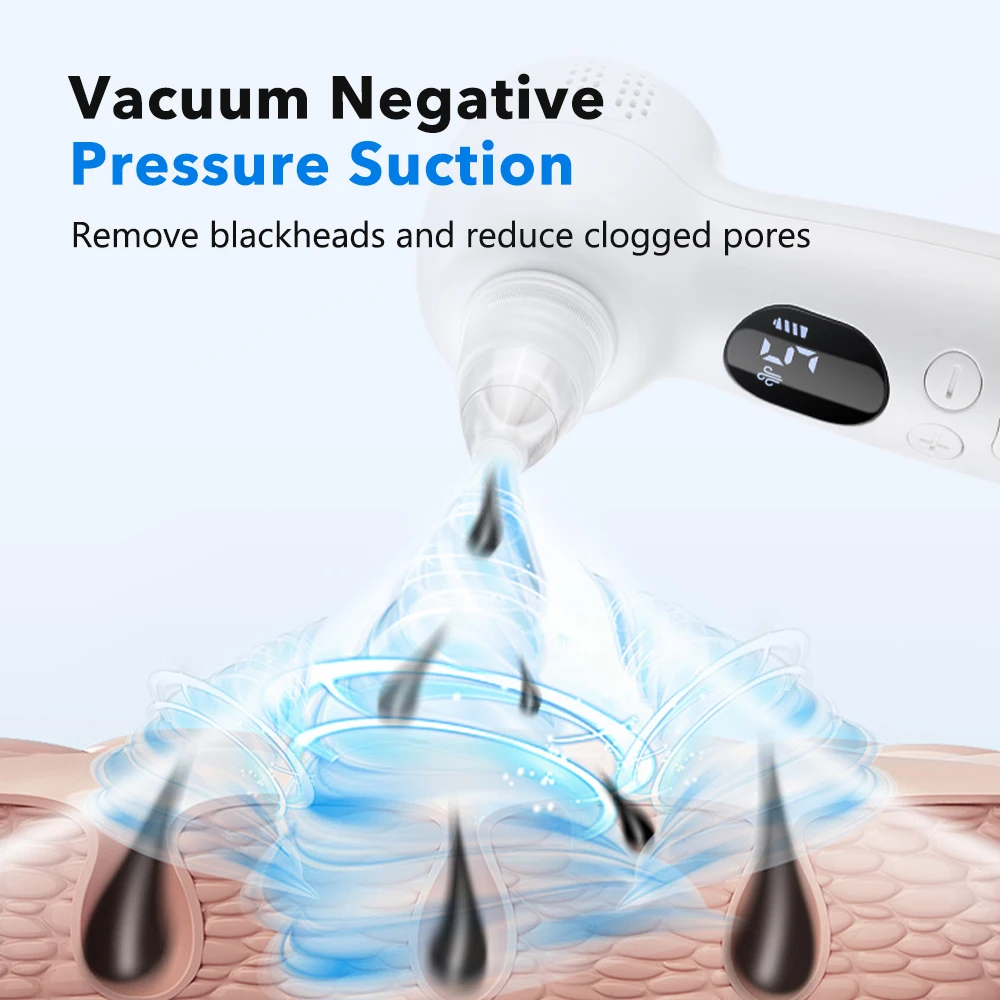 Removedor de Cravos a Vácuo Li - Pore Vacuum avaliação e preço